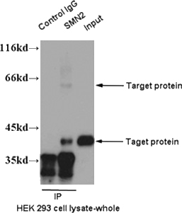IP result of anti-SMN2(Catalog No:115393 for IP and Detection).