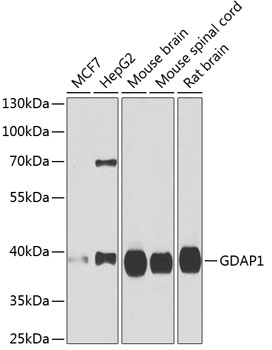 Western blot - GDAP1 Polyclonal Antibody 