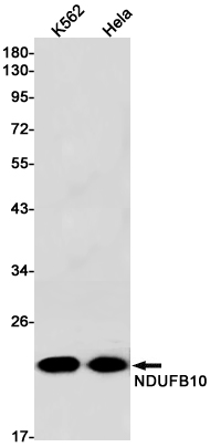 Western blot detection of NDUFB10 in K562,Hela cell lysates using NDUFB10 Rabbit pAb(1:1000 diluted).Predicted band size:21kDa.Observed band size:21kDa.