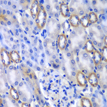 Immunohistochemistry - MATK Polyclonal Antibody 