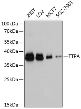 Western blot - TTPA Polyclonal Antibody 