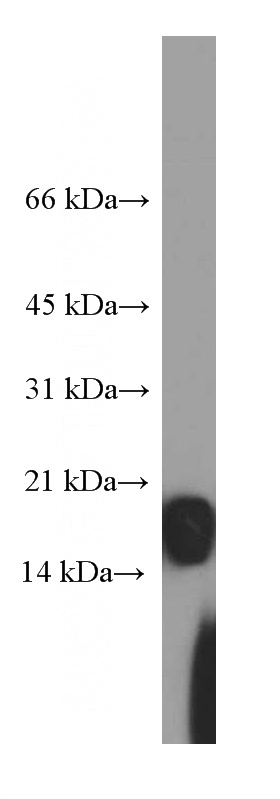 human heart tissue were subjected to SDS PAGE followed by western blot with Catalog No:107317(MB Antibody) at dilution of 1:40000