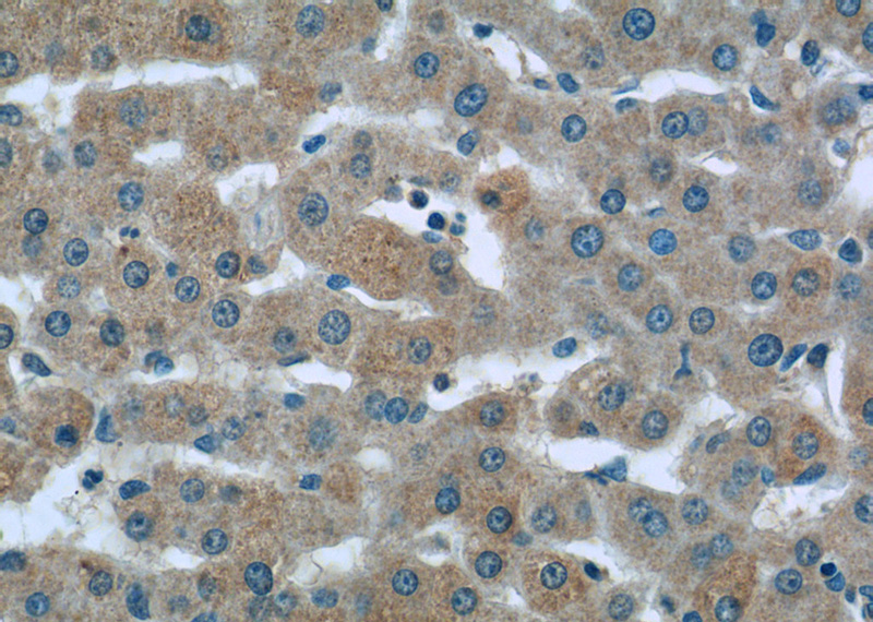 Immunohistochemistry of paraffin-embedded human liver tissue slide using Catalog No:114998(SOST Antibody) at dilution of 1:50 (under 40x lens)