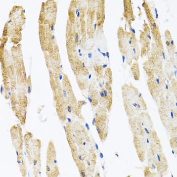Immunohistochemistry - COPB2 Polyclonal Antibody 