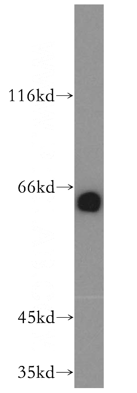 mouse brain tissue were subjected to SDS PAGE followed by western blot with Catalog No:110328(ENT1 antibody) at dilution of 1:500