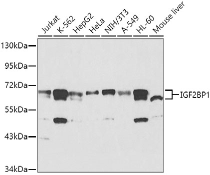 Western blot - IGF2BP1 Polyclonal Antibody 