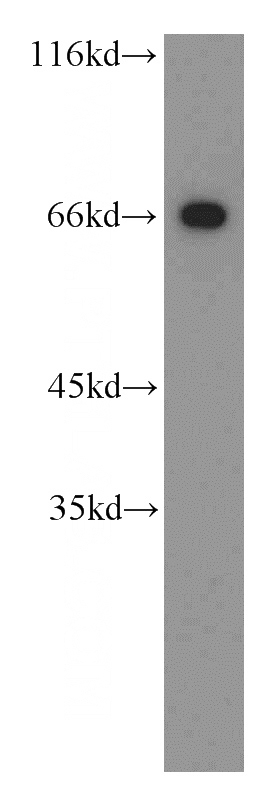 mouse testis tissue were subjected to SDS PAGE followed by western blot with Catalog No:114068(POTED-Specific antibody) at dilution of 1:300