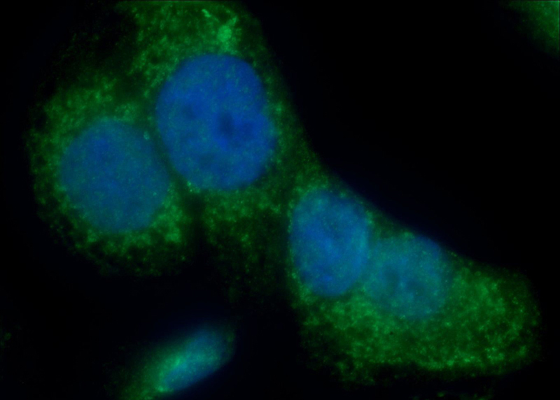 Immunofluorescent analysis of COLO 320 cells using Catalog No:111823(IQCK Antibody) at dilution of 1:50 and Alexa Fluor 488-congugated AffiniPure Goat Anti-Rabbit IgG(H+L)