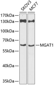 Western blot - MGAT1 Polyclonal Antibody 