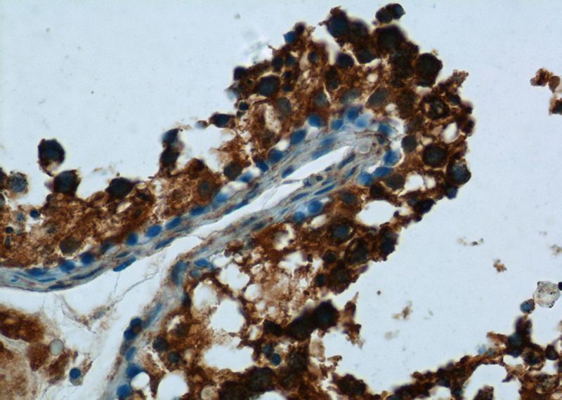 Immunohistochemistry of paraffin-embedded human testis tissue slide using Catalog No:116381(TTC32 Antibody) at dilution of 1:50 (under 40x lens)