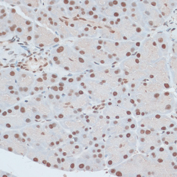 Immunohistochemistry - ZNF416 Polyclonal Antibody 
