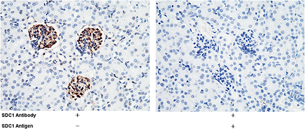 Syndecan-1 / SDC1 / CD138 Antibody, Rabbit PAb, Antigen Affinity Purified, Immunohistochemistry