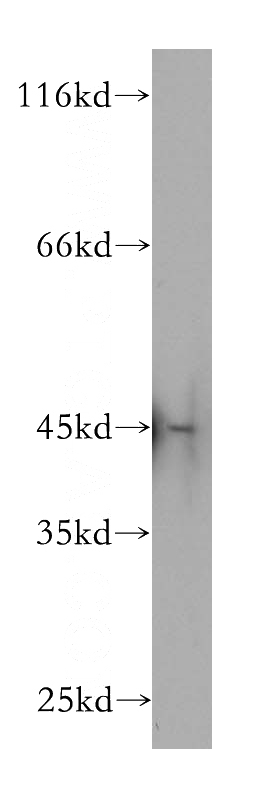 K-562 cells were subjected to SDS PAGE followed by western blot with Catalog No:113138(NF45 antibody) at dilution of 1:500