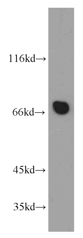 mouse cerebellum tissue were subjected to SDS PAGE followed by western blot with Catalog No:108163(ACTR5 antibody) at dilution of 1:500