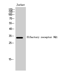 Fig1:; Western Blot analysis of Jurkat cells using Olfactory receptor 9Q1 Polyclonal Antibody