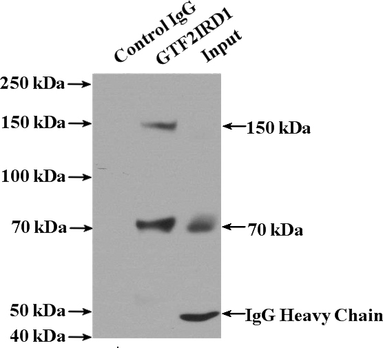 IP Result of anti-GTF2IRD1 (IP:Catalog No:111237, 4ug; Detection:Catalog No:111237 1:500) with mouse liver tissue lysate 4000ug.