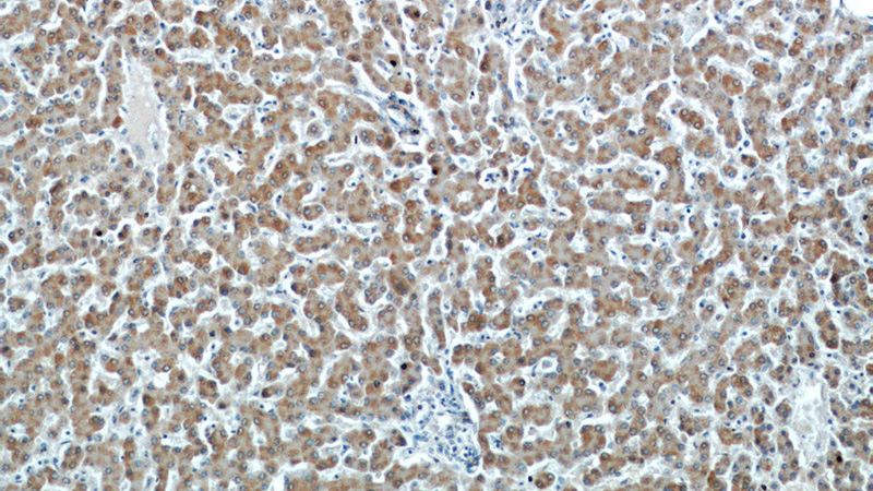 Immunohistochemical of paraffin-embedded human liver using Catalog No:113908(PIN4 antibody) at dilution of 1:50 (under 10x lens)