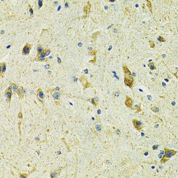 Immunohistochemistry - SLC25A11 Polyclonal Antibody 