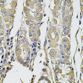 Immunohistochemistry - PTHLH Polyclonal Antibody 