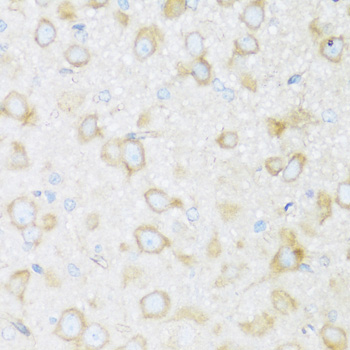 Immunohistochemistry - BRSK1 Polyclonal Antibody 