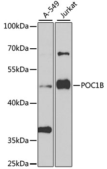 Western blot - POC1B Polyclonal Antibody 