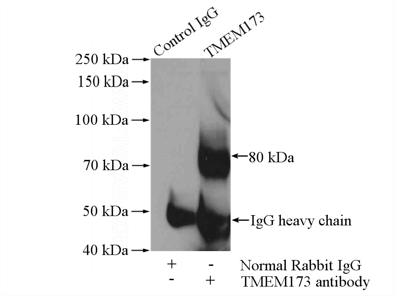 IP Result of anti-TMEM173 (IP:Catalog No:116105, 4ug; Detection:Catalog No:116105 1:1000) with mouse spleen tissue lysate 4000ug.