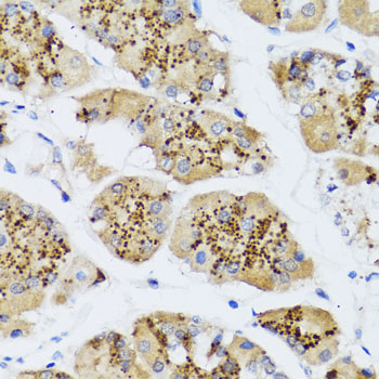 Immunohistochemistry - CHIC2 Polyclonal Antibody 