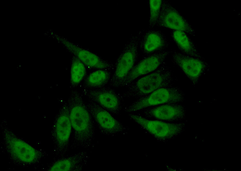 Immunofluorescent analysis of (10% Formaldehyde) fixed HeLa cells using Catalog No:112638(MEF2D Antibody) at dilution of 1:50 and Alexa Fluor 488-congugated AffiniPure Goat Anti-Rabbit IgG(H+L)