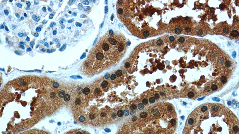 Immunohistochemistry of paraffin-embedded human kidney tissue slide using Catalog No:107170(COTL1 Antibody) at dilution of 1:50