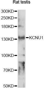 Western blot - KCNU1 Polyclonal Antibody 