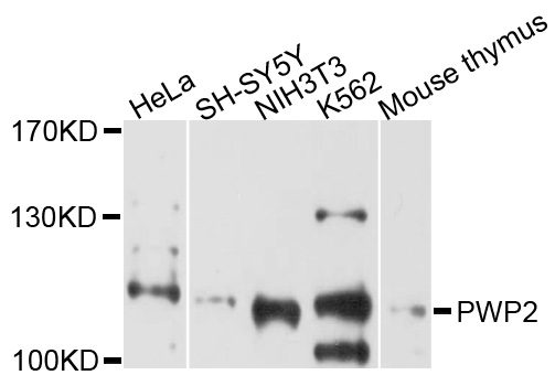 Western blot - PWP2 Polyclonal Antibody 