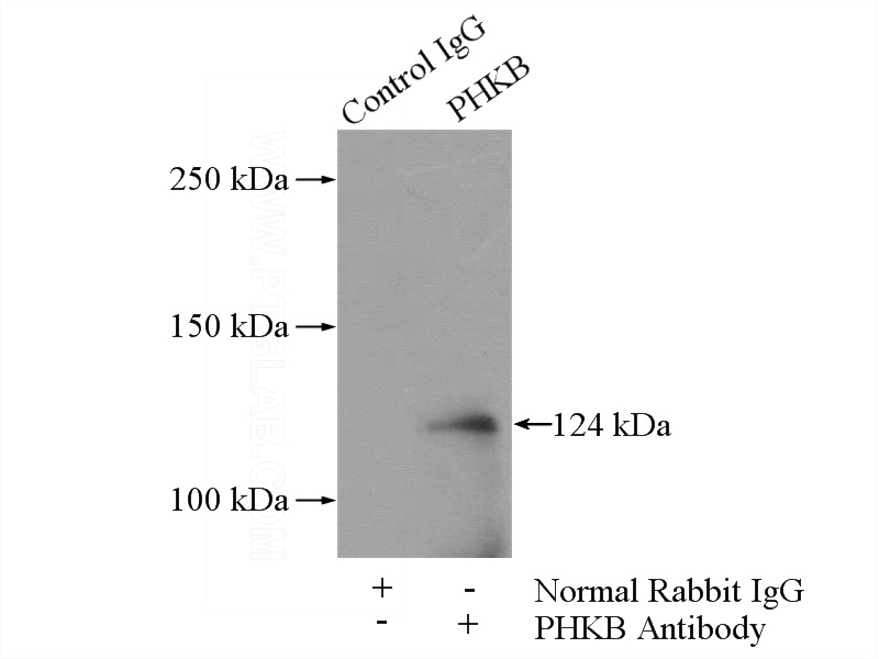 IP Result of anti-PHKB (IP:Catalog No:113820, 4ug; Detection:Catalog No:113820 1:500) with mouse heart tissue lysate 3200ug.