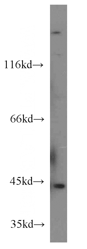 HeLa cells were subjected to SDS PAGE followed by western blot with Catalog No:107356(IVD antibody) at dilution of 1:1000