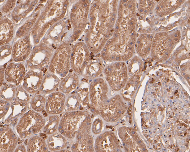 Fig2:; Immunohistochemical analysis of paraffin-embedded human kidney tissue using anti-Smg1 antibody. The section was pre-treated using heat mediated antigen retrieval with sodium citrate buffer (pH 6.0) for 20 minutes. The tissues were blocked in 5% BSA for 30 minutes at room temperature, washed with ddH; 2; O and PBS, and then probed with the primary antibody ( 1/400) for 30 minutes at room temperature. The detection was performed using an HRP conjugated compact polymer system. DAB was used as the chromogen. Tissues were counterstained with hematoxylin and mounted with DPX.