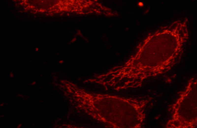 Immunofluorescent analysis of HepG2 cells using Catalog No:112234(Lin28B-specific Antibody) at dilution of 1:25 and Rhodamine-Goat anti-Rabbit IgG