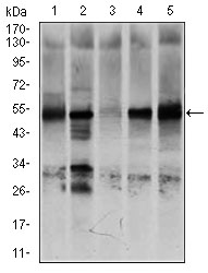 Western blot analysis using NR6A1 mouse mAb against K562 (1), NTERA-2 (2), HEK293 (3), HUVE-12 (4), and HeLa (5) cell lysate.