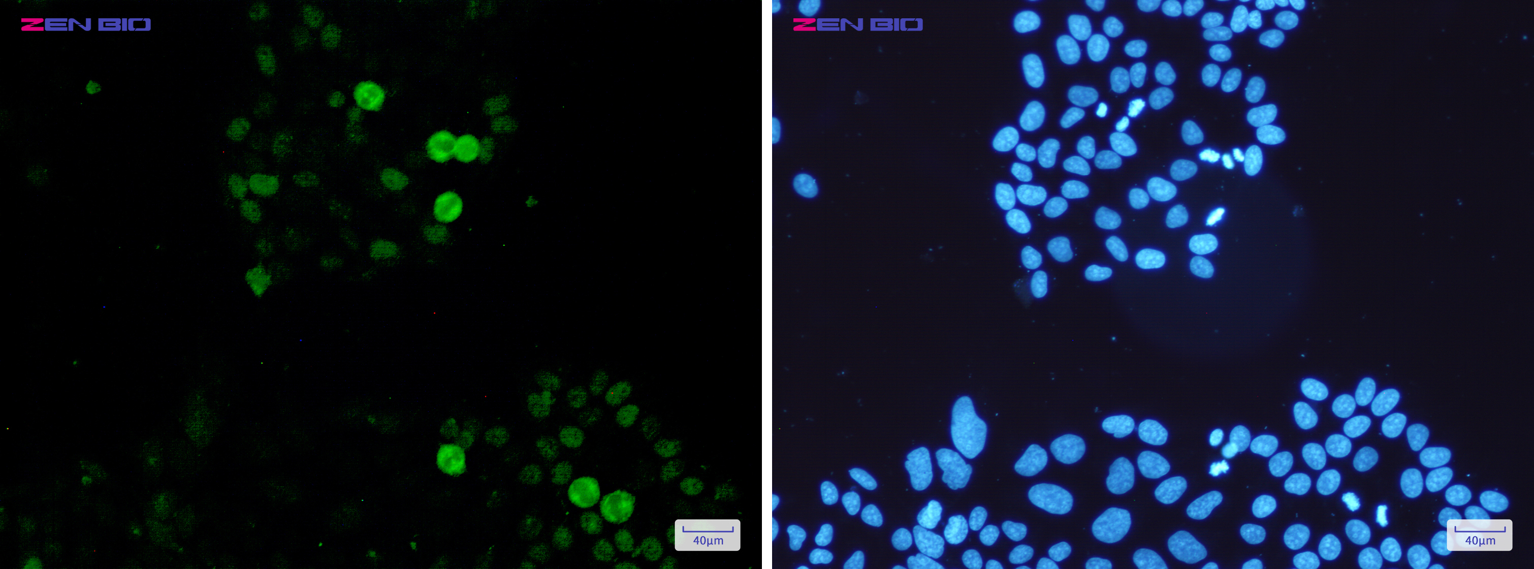 Immunocytochemistry of c-Myc (Phospho-Ser62)(green) in Hela cells using c-Myc (Phospho-Ser62) Rabbit pAb at dilution 1/50, and DAPI(blue)