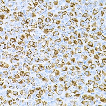 Immunohistochemistry - DLK1 Polyclonal Antibody 