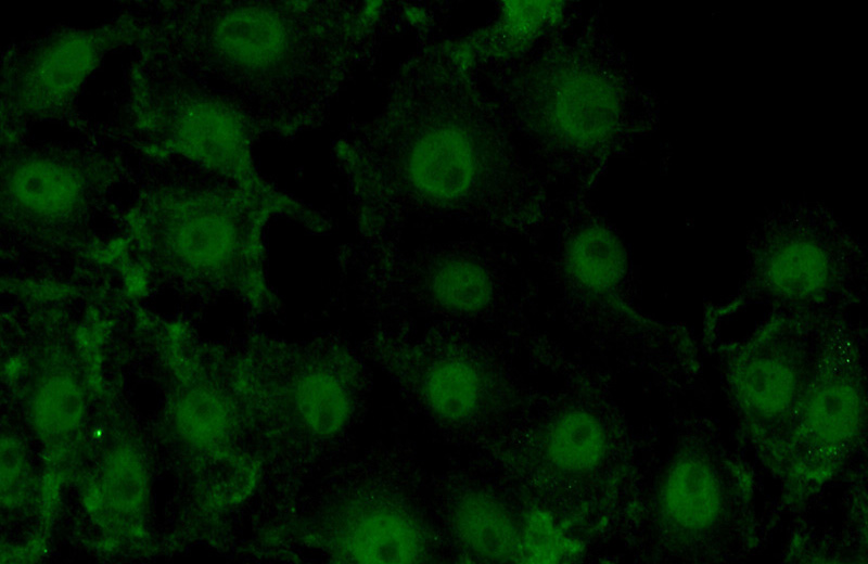 Immunofluorescent analysis of (10% Formaldehyde) fixed SH-SY5Y cells using Catalog No:107726(ACAP3 Antibody) at dilution of 1:50 and Alexa Fluor 488-congugated AffiniPure Goat Anti-Rabbit IgG(H+L)