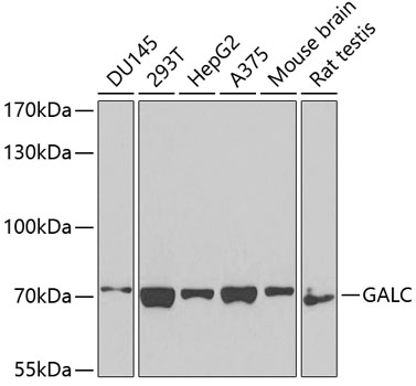 Western blot - GALC Polyclonal Antibody 