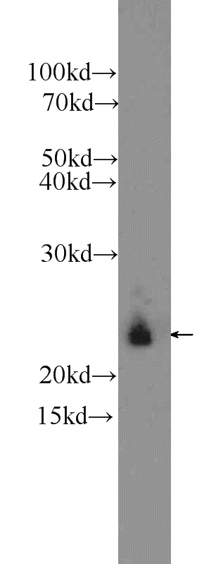 SKOV-3 cells were subjected to SDS PAGE followed by western blot with Catalog No:107836(AGR3 Antibody) at dilution of 1:600