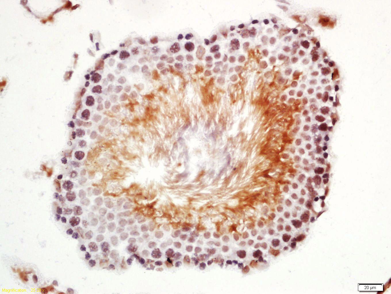 Fig3: Tissue/cell: rat testis tissue; 4% Paraformaldehyde-fixed and paraffin-embedded;; Antigen retrieval: citrate buffer ( 0.01M, pH 6.0 ), Boiling bathing for 15min; Block endogenous peroxidase by 3% Hydrogen peroxide for 30min; Blocking buffer (normal goat serum,C-0005) at 37℃ for 20 min;; Incubation: Anti-Nanog Polyclonal Antibody, Unconjugated 1:200, overnight at 4℃, followed by conjugation to the secondary antibody(SP-0023) and DAB(C-0010) staining
