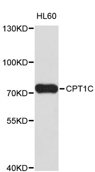 Western blot - CPT1C Polyclonal Antibody 