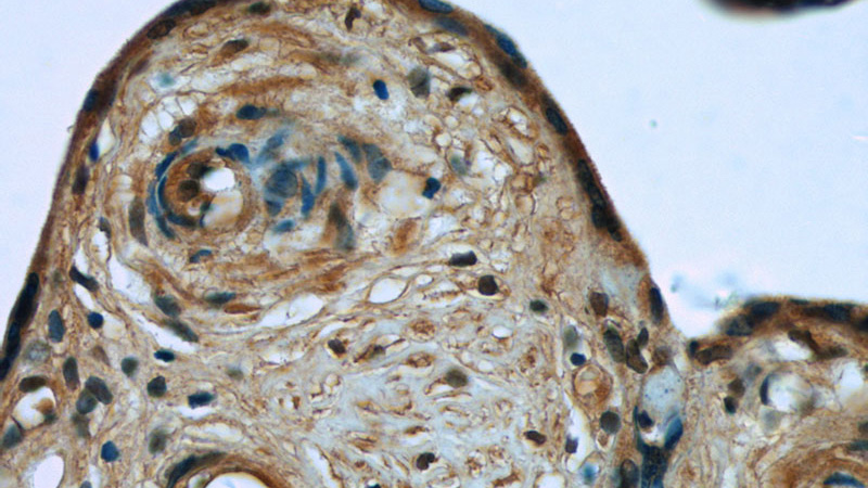 Immunohistochemistry of paraffin-embedded human placenta tissue slide using Catalog No:115488(SocS1 Antibody) at dilution of 1:50 (under 40x lens)