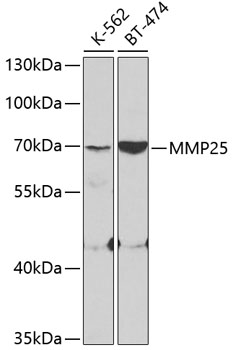 Western blot - MMP25 Polyclonal Antibody 