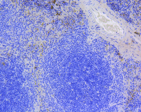 Fig5:; Immunohistochemical analysis of paraffin-embedded mouse spleen tissue using anti-Survivin antibody. The section was pre-treated using heat mediated antigen retrieval with Tris-EDTA buffer (pH 8.0-8.4) for 20 minutes.The tissues were blocked in 5% BSA for 30 minutes at room temperature, washed with ddH; 2; O and PBS, and then probed with the primary antibody ( 1/200) for 30 minutes at room temperature. The detection was performed using an HRP conjugated compact polymer system. DAB was used as the chromogen. Tissues were counterstained with hematoxylin and mounted with DPX.
