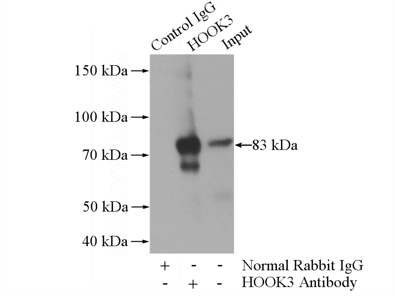 IP Result of anti-HOOK3 (IP:Catalog No:111522, 4ug; Detection:Catalog No:111522 1:500) with mouse kidney tissue lysate 4000ug.