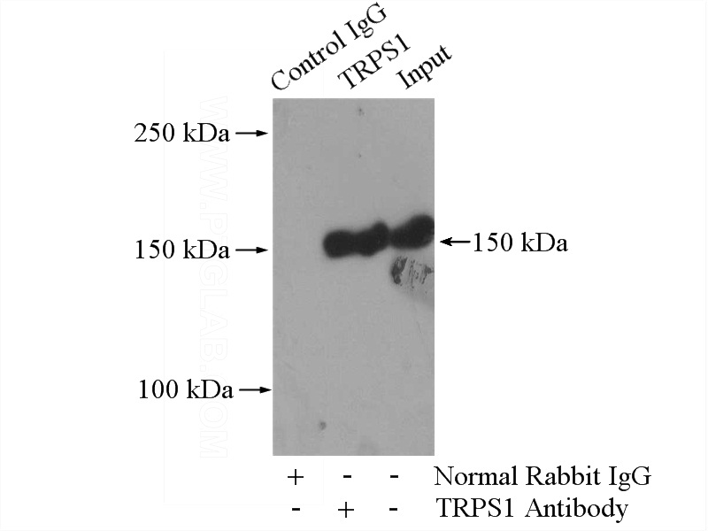 IP Result of anti-TRPS1 (IP:Catalog No:116415, 4ug; Detection:Catalog No:116415 1:1000) with mouse lung tissue lysate 3600ug.
