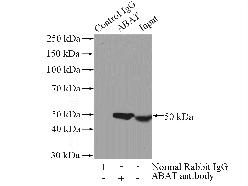 IP Result of anti-ABAT (IP:Catalog No:107679, 4ug; Detection:Catalog No:107679 1:500) with mouse liver tissue lysate 4000ug.