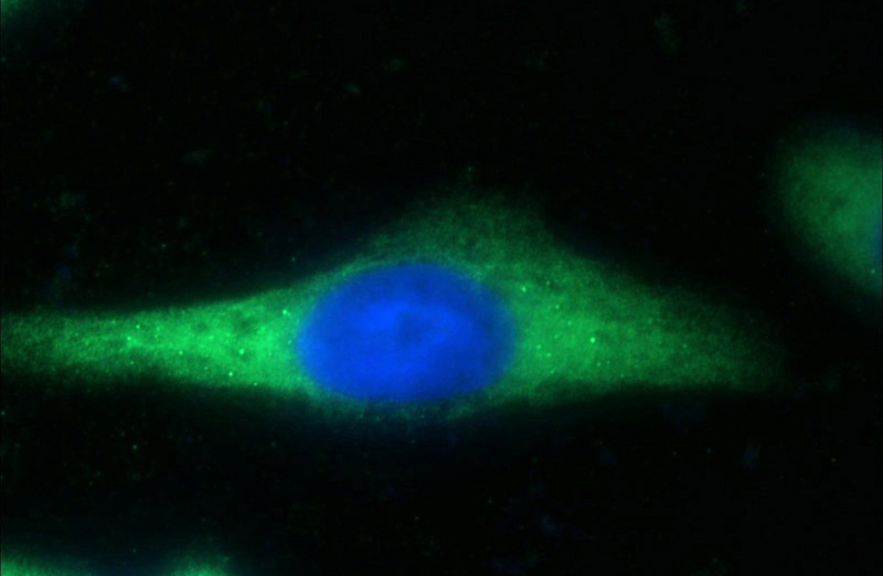 Immunofluorescent analysis of HeLa cells using Catalog No:110109(DNAJC21 Antibody) at dilution of 1:50 and Alexa Fluor 488-congugated AffiniPure Goat Anti-Rabbit IgG(H+L)